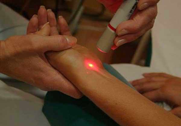 Лазерная терапия при псориазе